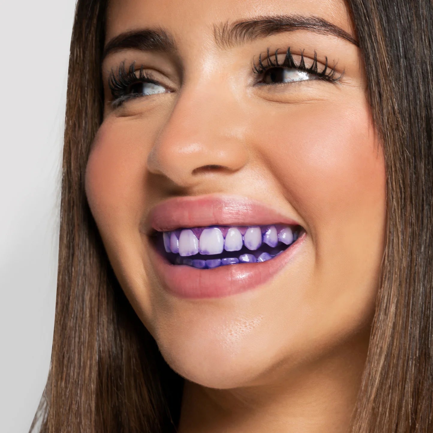 Femme souriante avec correcteur violet V34 Smilee appliqué sur les dents – démonstration.